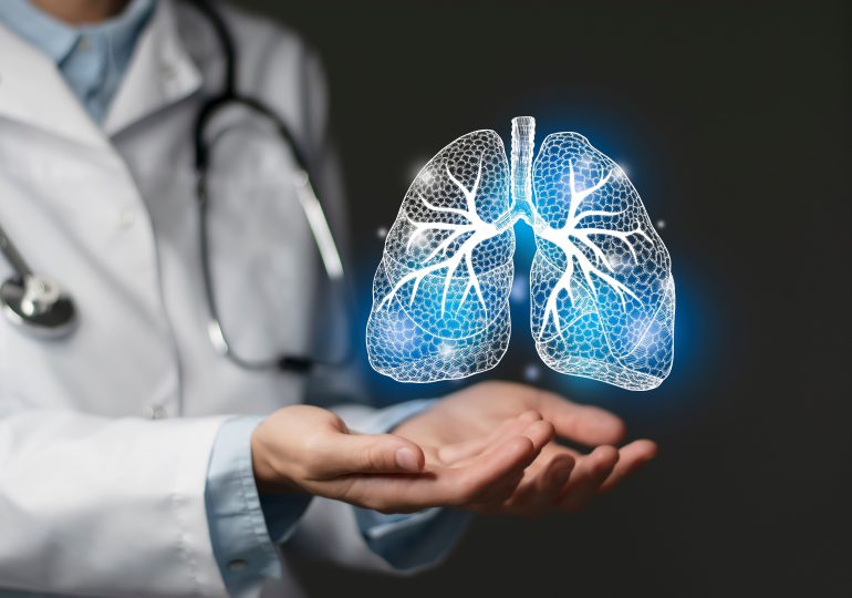 AstraZeneca presenta una nueva alternativa terapéutica para el cáncer de pulmón AstraZeneca presenta una nueva alternativa terapéutica para el cáncer de pulmón