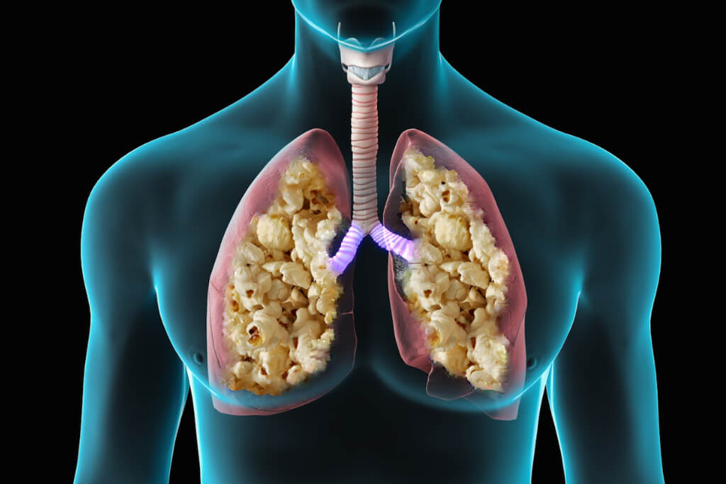 El uso de Vape podría aumentar el riesgo de “pulmón de palomitas de maíz”