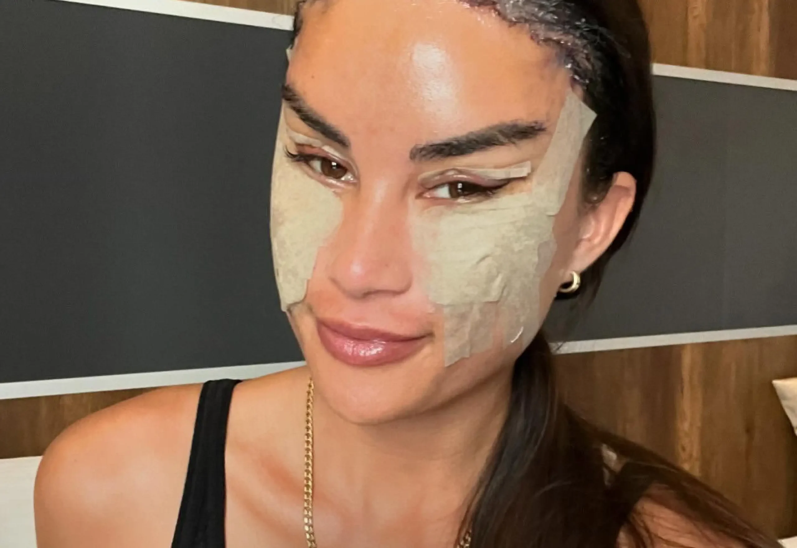 ¡Se redujo la frente y las redes no lo pueden creer! El antes y después de esta influencer está dando de qué hablar