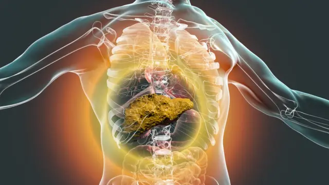 Estudio relaciona alcohol con mayor riesgo de cáncer de páncreas Estudio relaciona alcohol con mayor riesgo de cáncer de páncreas